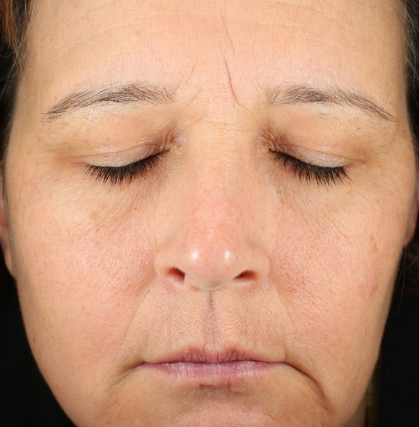 PM Gentle Anti-Aging Serum — Week 12