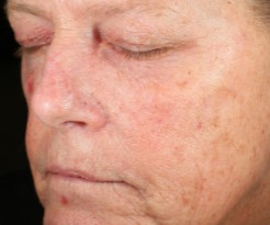 PM Gentle Anti-Aging Serum — Week 12